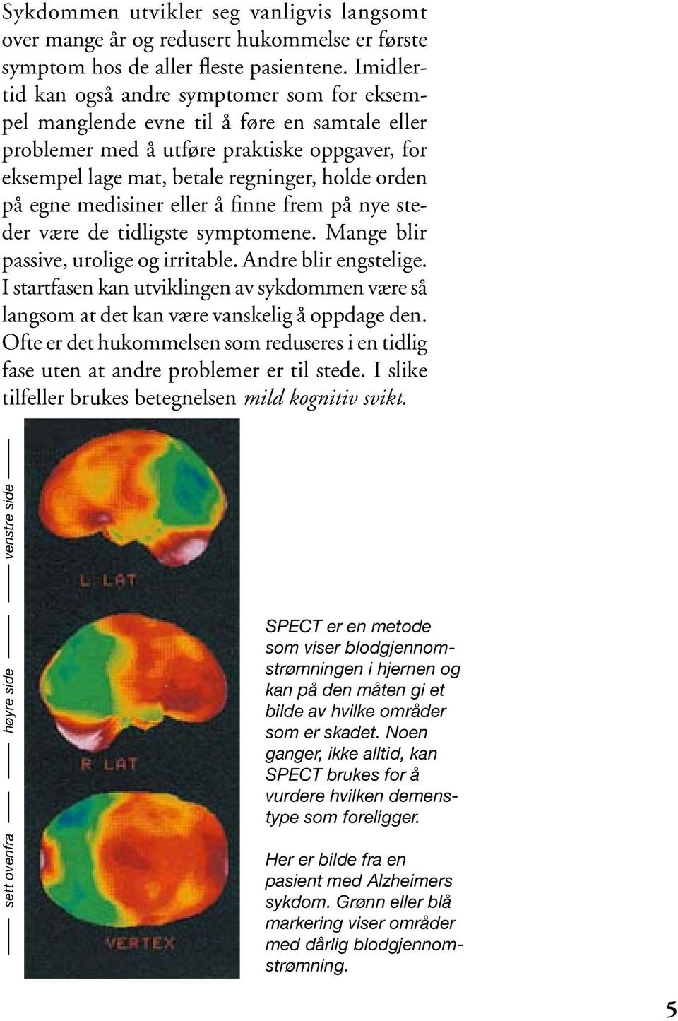 medisiner eller å finne frem på nye steder være de tidligste symptomene. Mange blir passive, urolige og irritable. Andre blir engstelige.