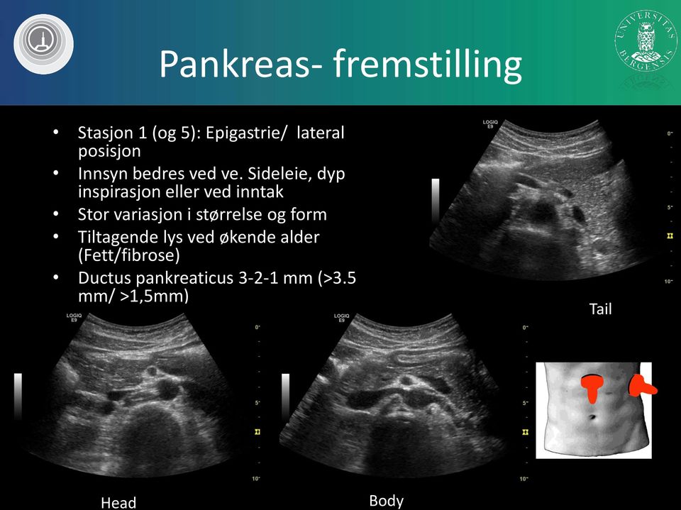 Sideleie, dyp inspirasjon eller ved inntak av vann Stor variasjon i