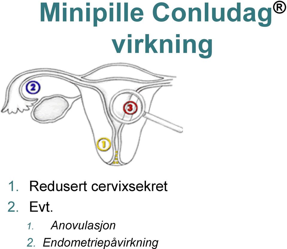 Redusert cervixsekret 2.