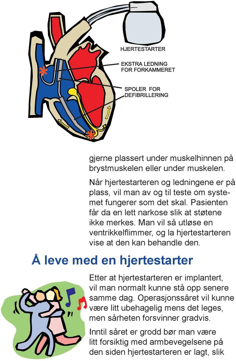 Pasienten får da en lett narkose slik at støtene ikke merkes. Man vil så utløse en ventrikkel flimmer, og la hjertestarteren vise at den kan behandle den.