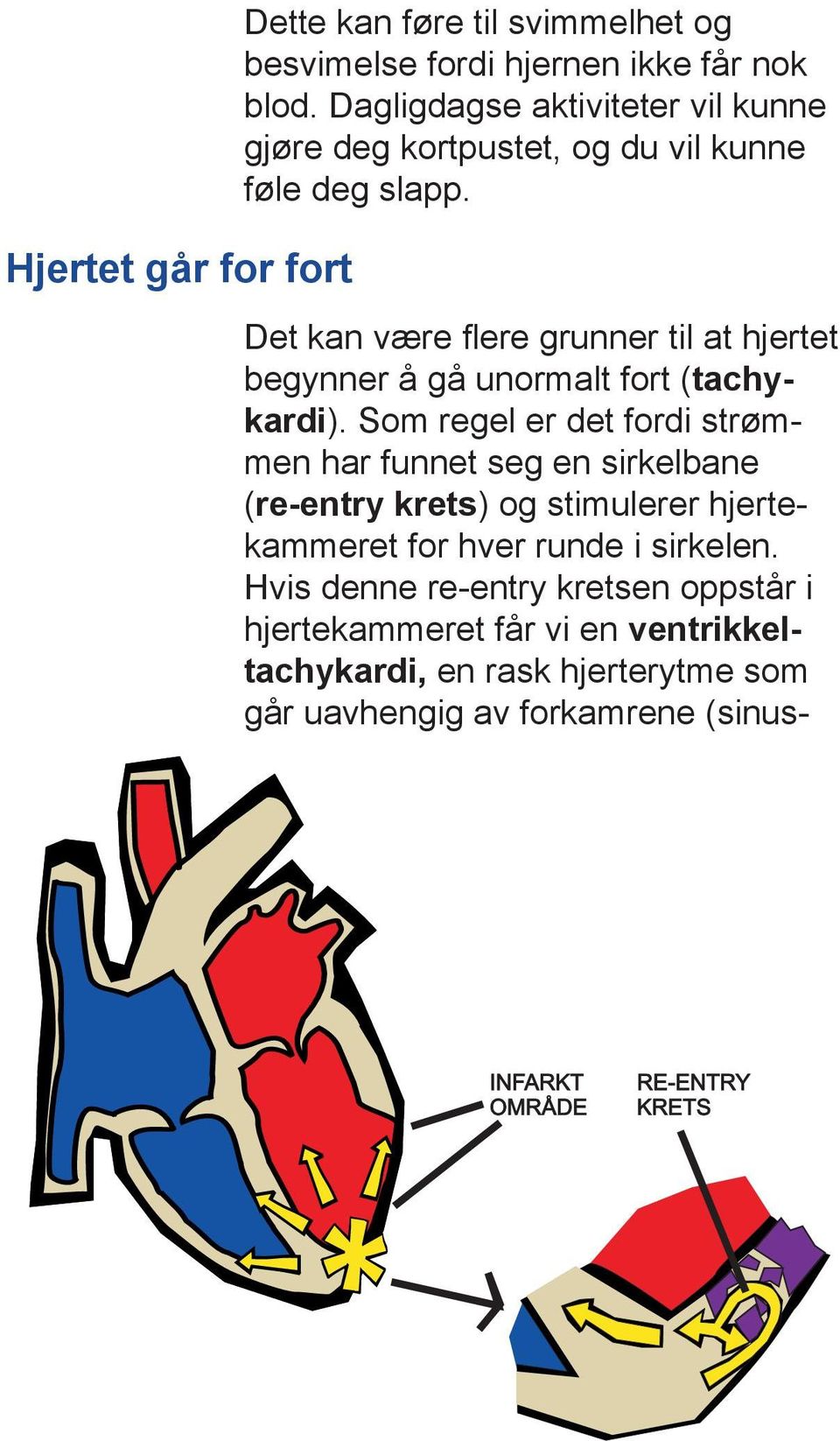 Det kan være flere grunner til at hjertet begynner å gå unormalt fort (tachykardi).