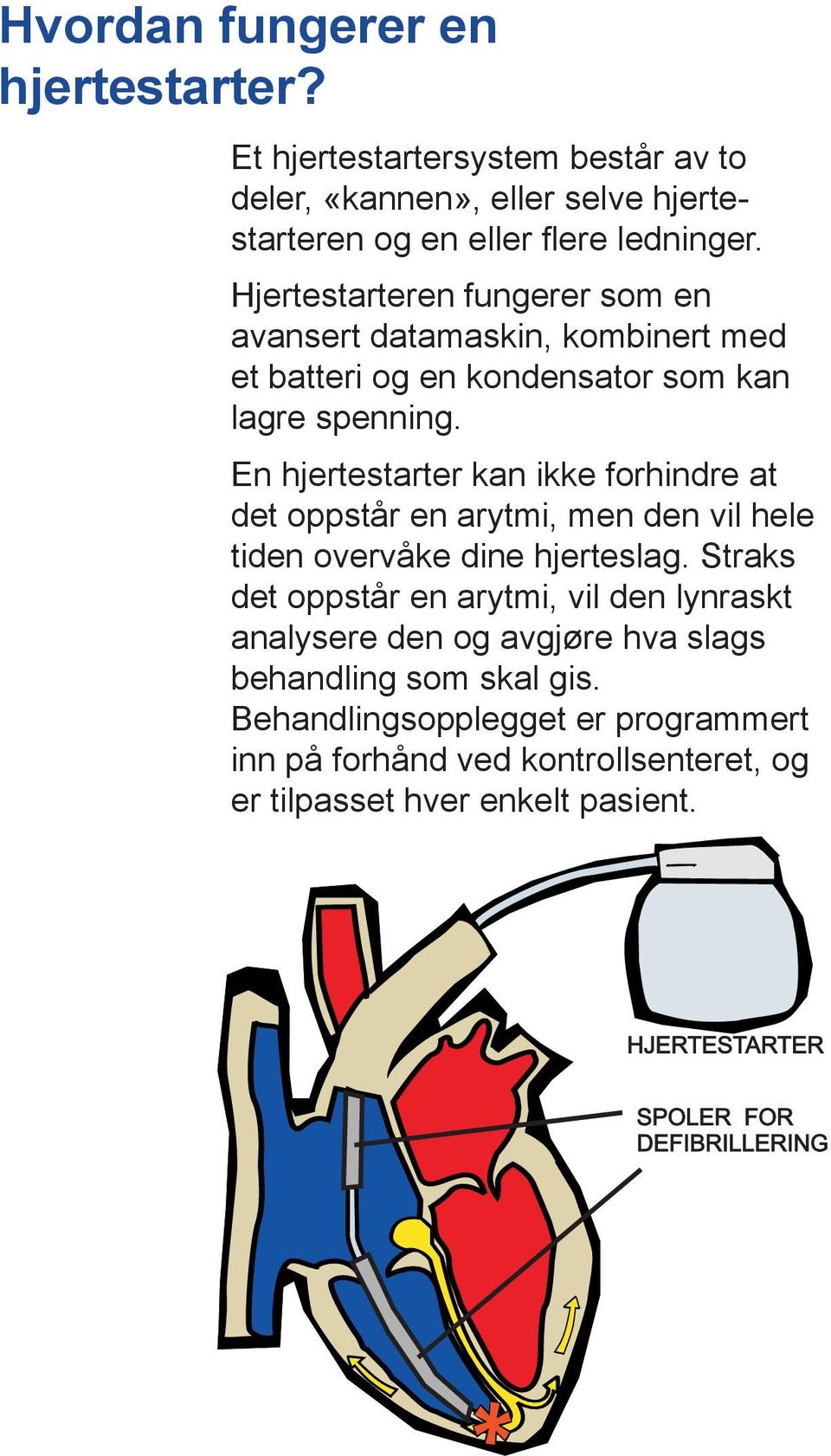 En hjertestarter kan ikke forhindre at det oppstår en arytmi, men den vil hele tiden overvåke dine hjerteslag.