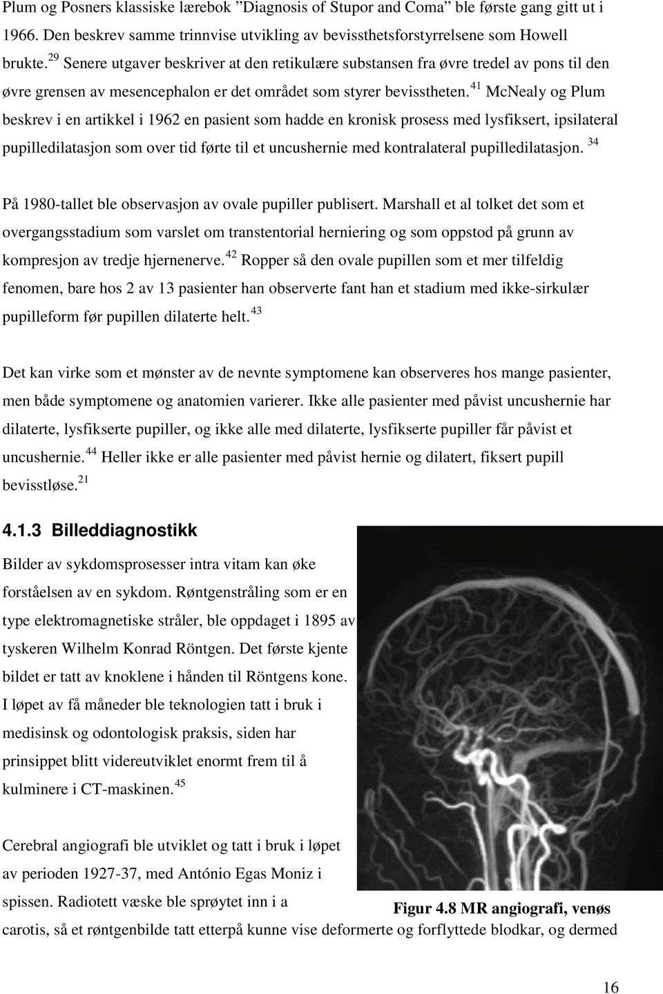 41 McNealy og Plum beskrev i en artikkel i 1962 en pasient som hadde en kronisk prosess med lysfiksert, ipsilateral pupilledilatasjon som over tid førte til et uncushernie med kontralateral