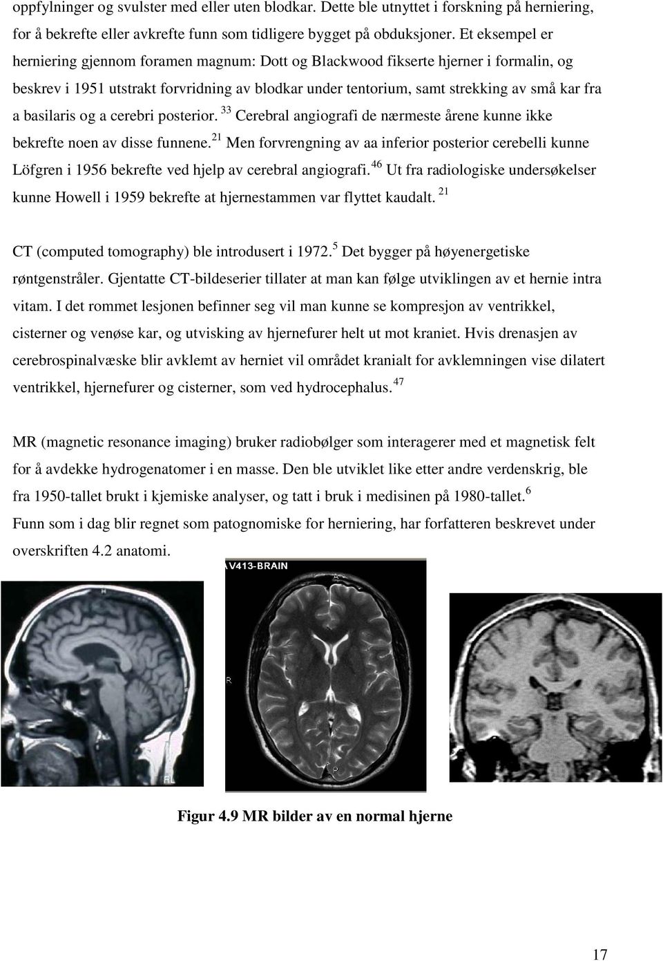 basilaris og a cerebri posterior. 33 Cerebral angiografi de nærmeste årene kunne ikke bekrefte noen av disse funnene.