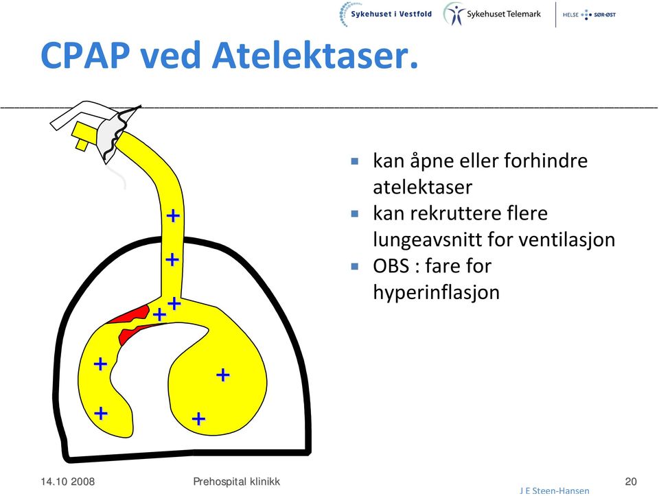 atelektaser kan rekruttere flere