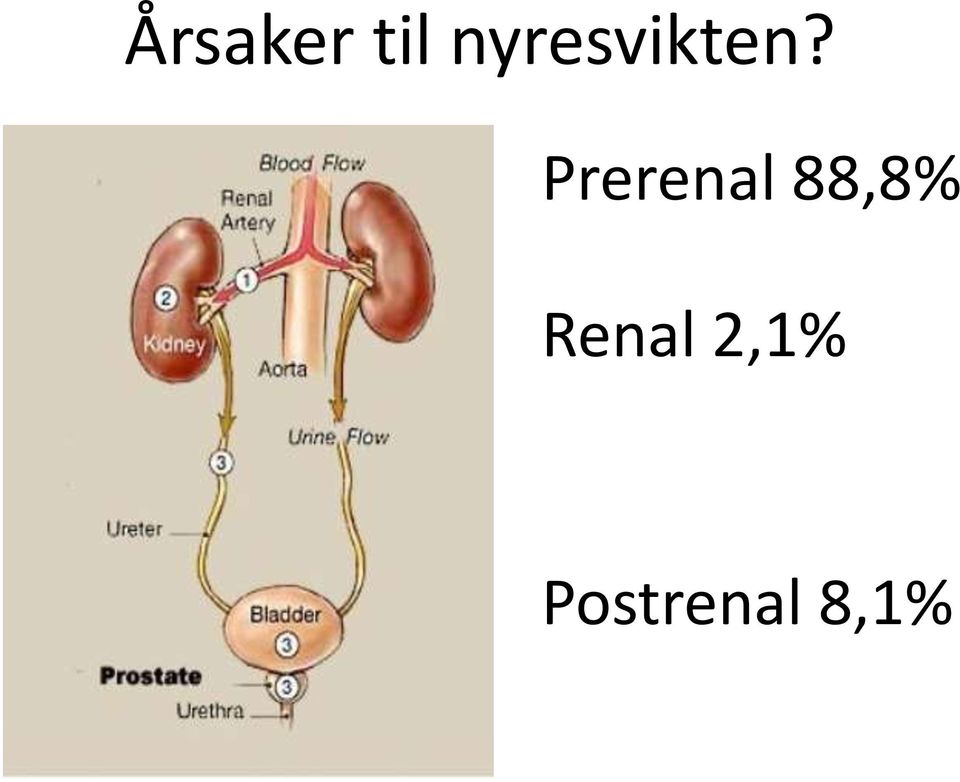 Prerenal 88,8%