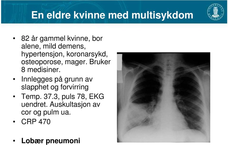 Bruker 8 medisiner. Innlegges på grunn av slapphet og forvirring Temp.