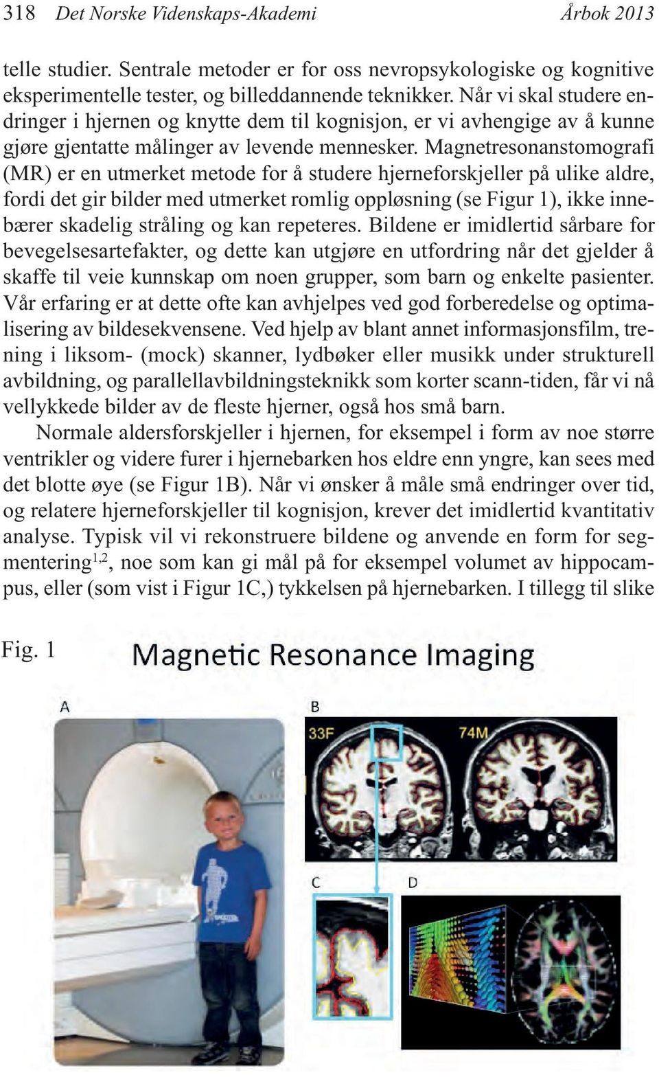 Magnetresonanstomografi (MR) er en utmerket metode for å studere hjerneforskjeller på ulike aldre, fordi det gir bilder med utmerket romlig oppløsning (se Figur 1), ikke innebærer skadelig stråling
