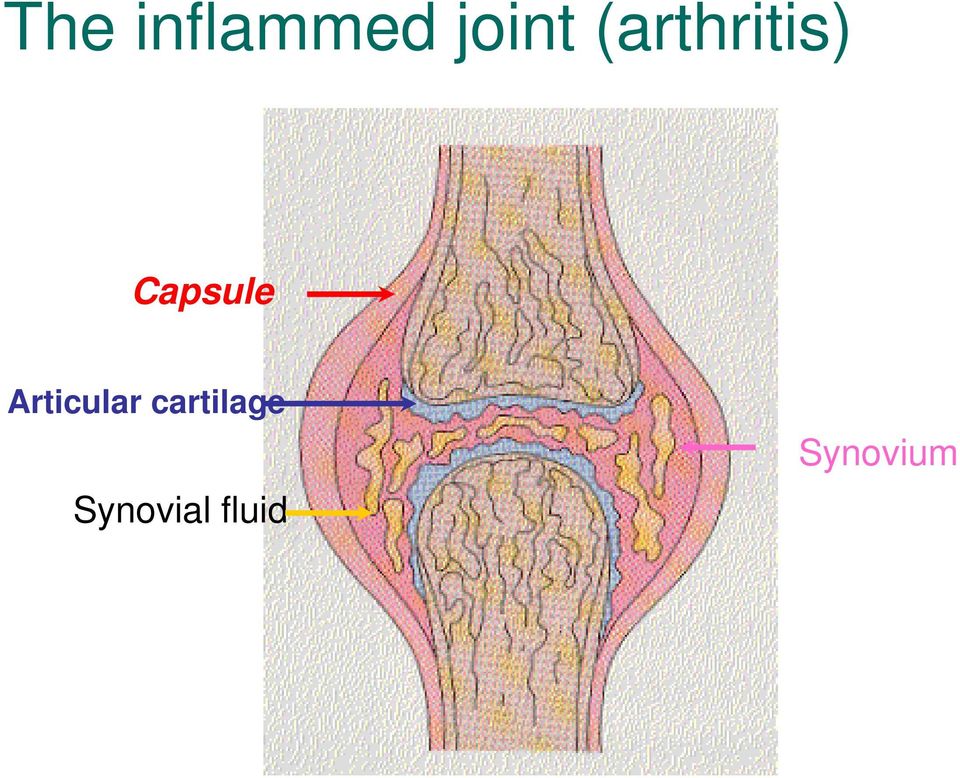 Articular cartilage