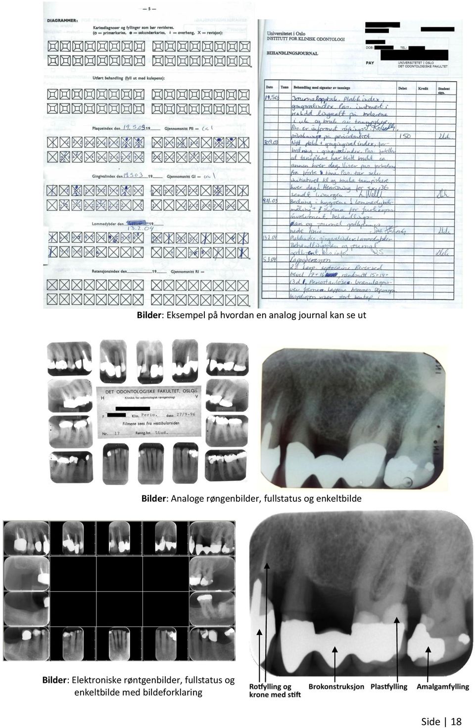 enkeltbilde Bilder: Elektroniske røntgenbilder,