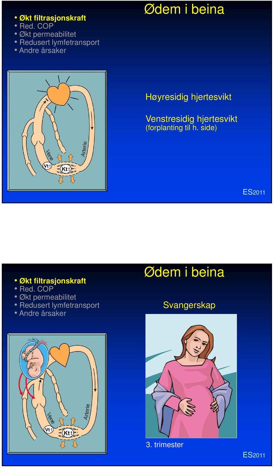 hjertesvikt (forplanting til h.