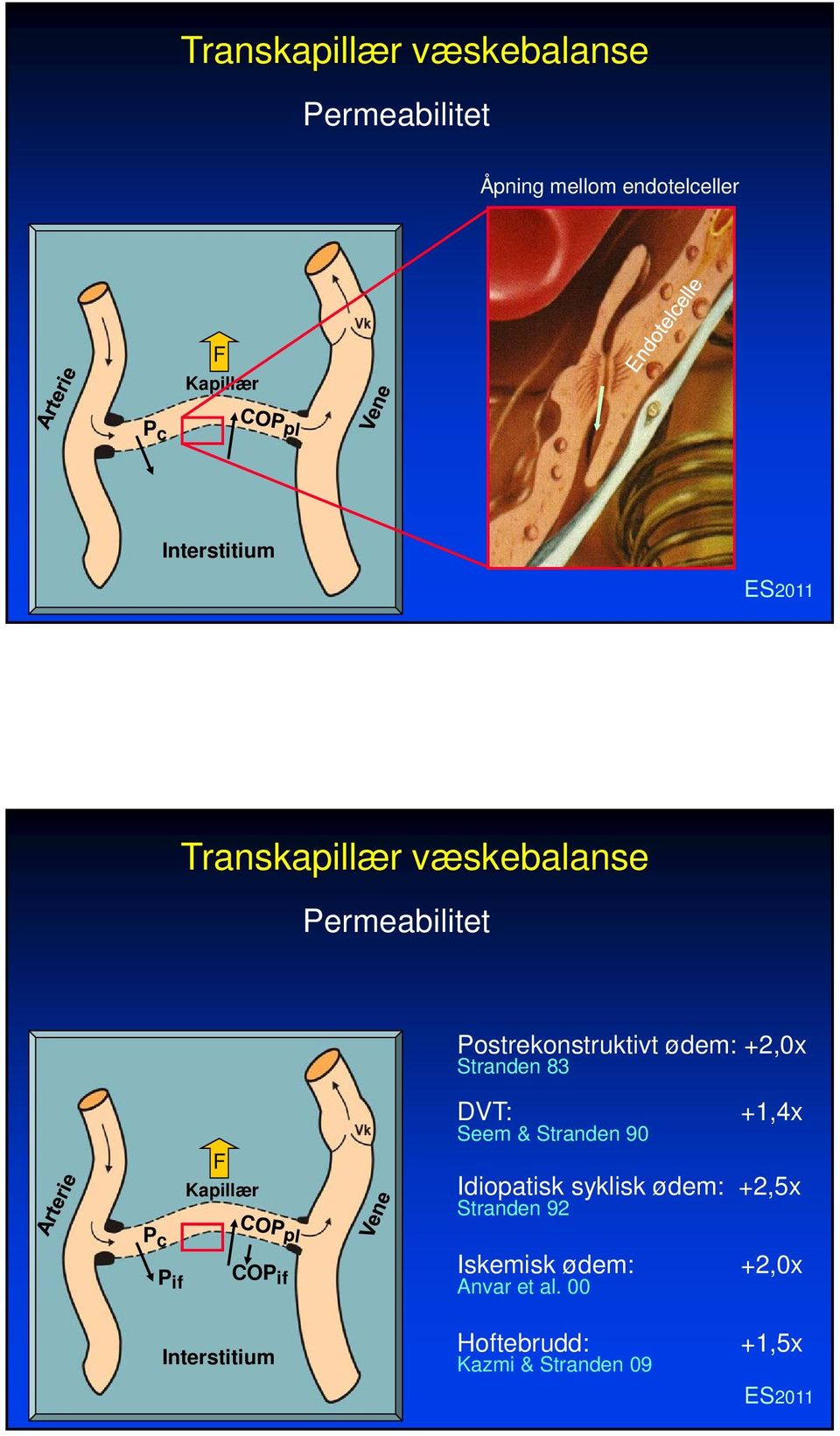 Stranden 83 F Kapillær P c P if COP if DVT: Seem & Stranden 90 +1,4x Idiopatisk syklisk ødem: