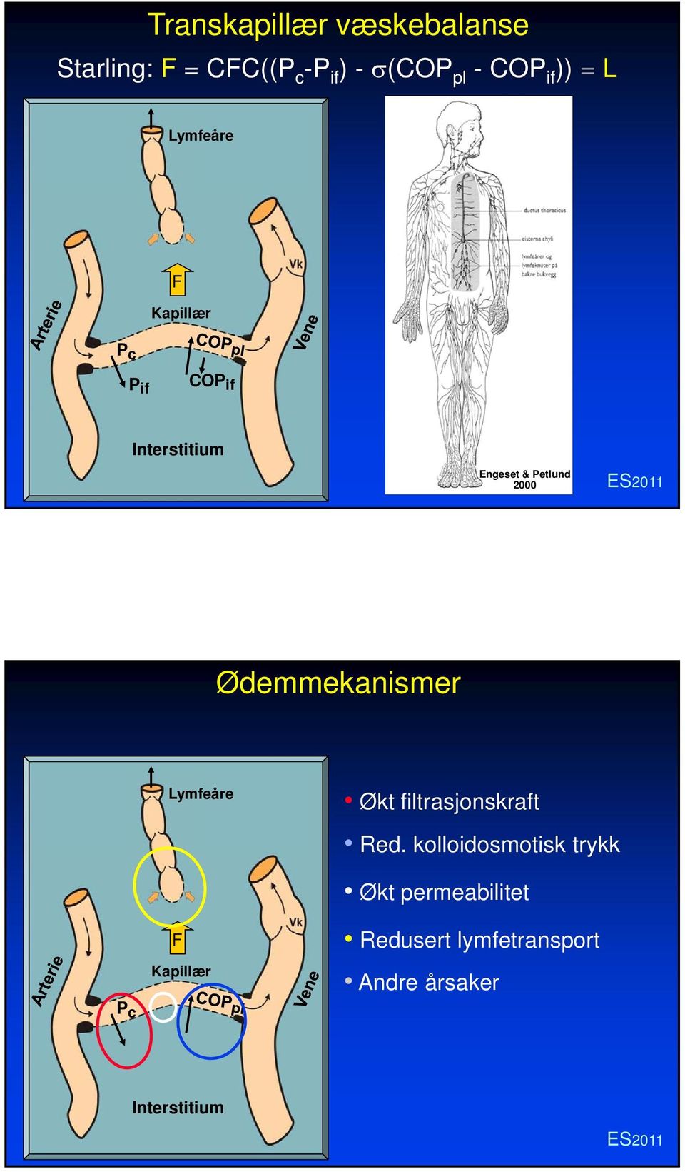 Interstitium Engeset & Petlund 2000 Ødemmekanismer Lymfeåre Økt