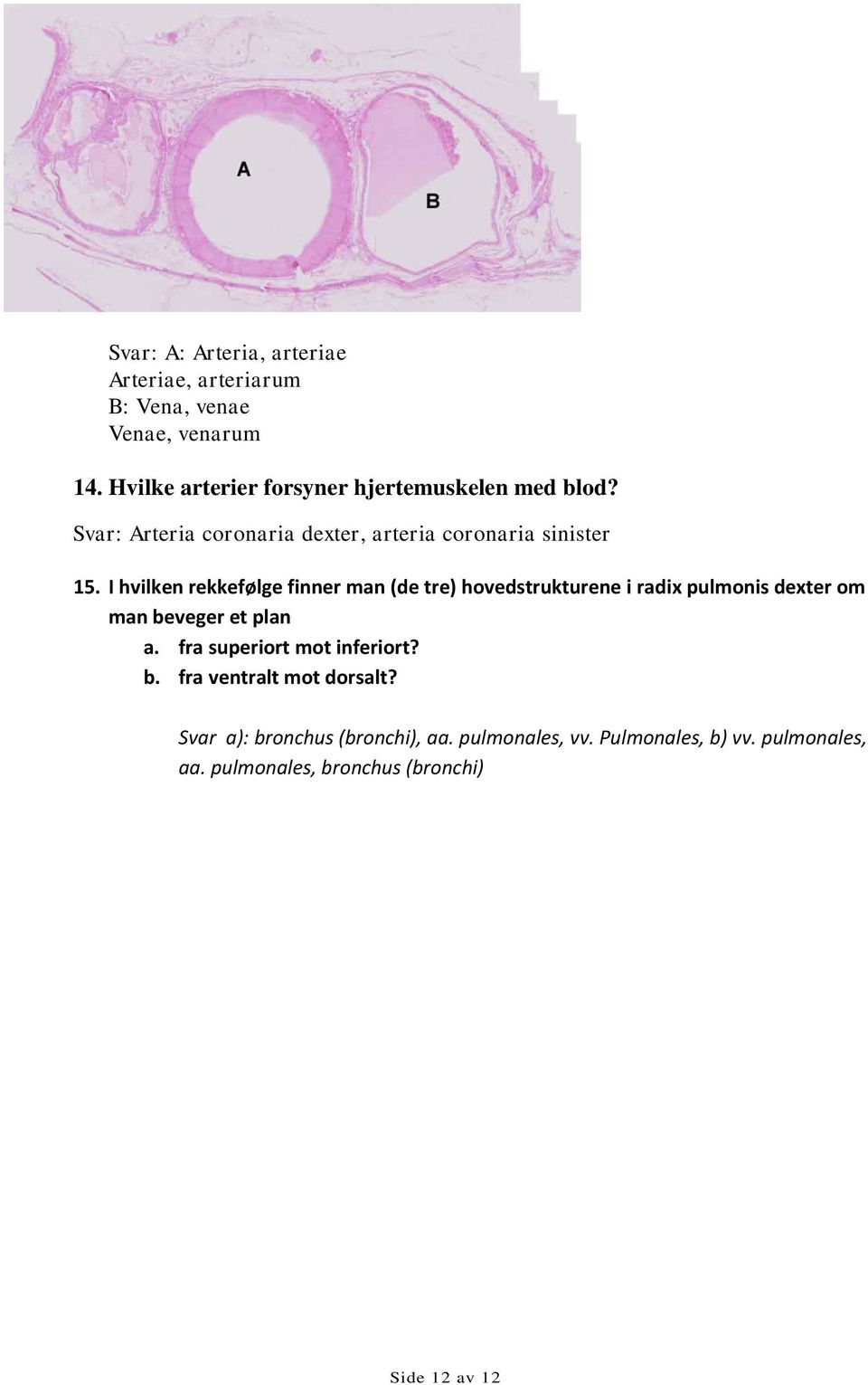 I hvilken rekkefølge finner man (de tre) hovedstrukturene i radix pulmonis dexter om man beveger et plan a.