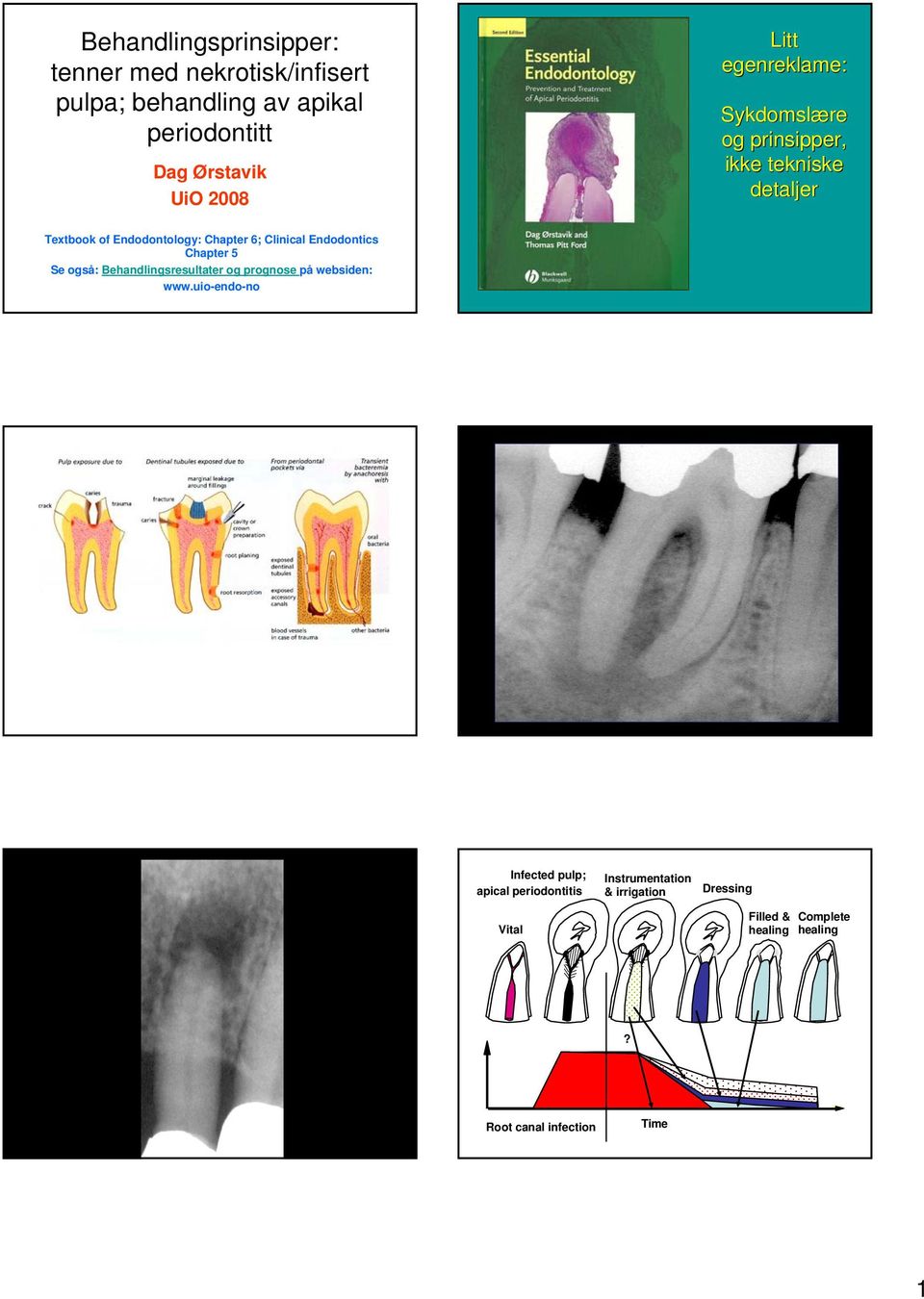 Clinical Endodontics Chapter 5 Se også: Behandlingsresultater og prognose på websiden: www.