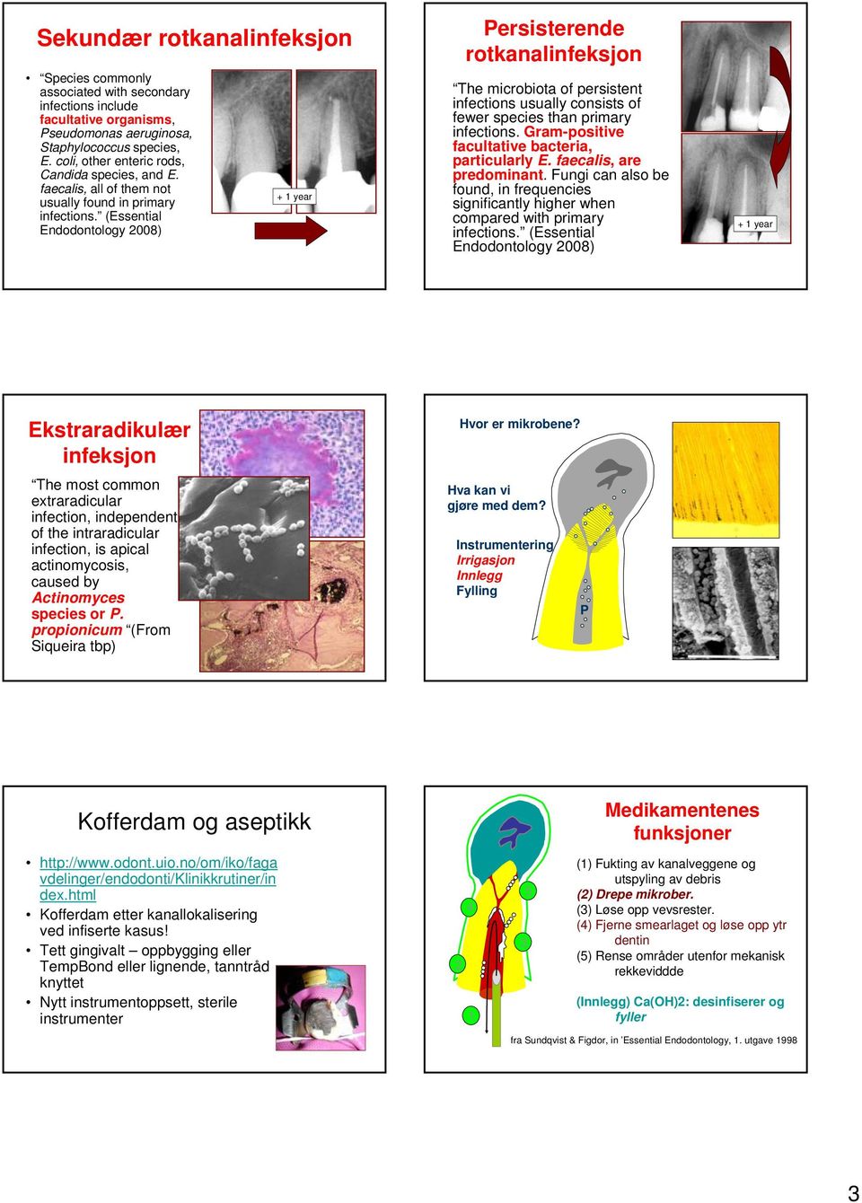 (Essential Endodontology 2008) + 1 year Persisterende rotkanalinfeksjon The microbiota of persistent infections usually consists of fewer species than primary infections.