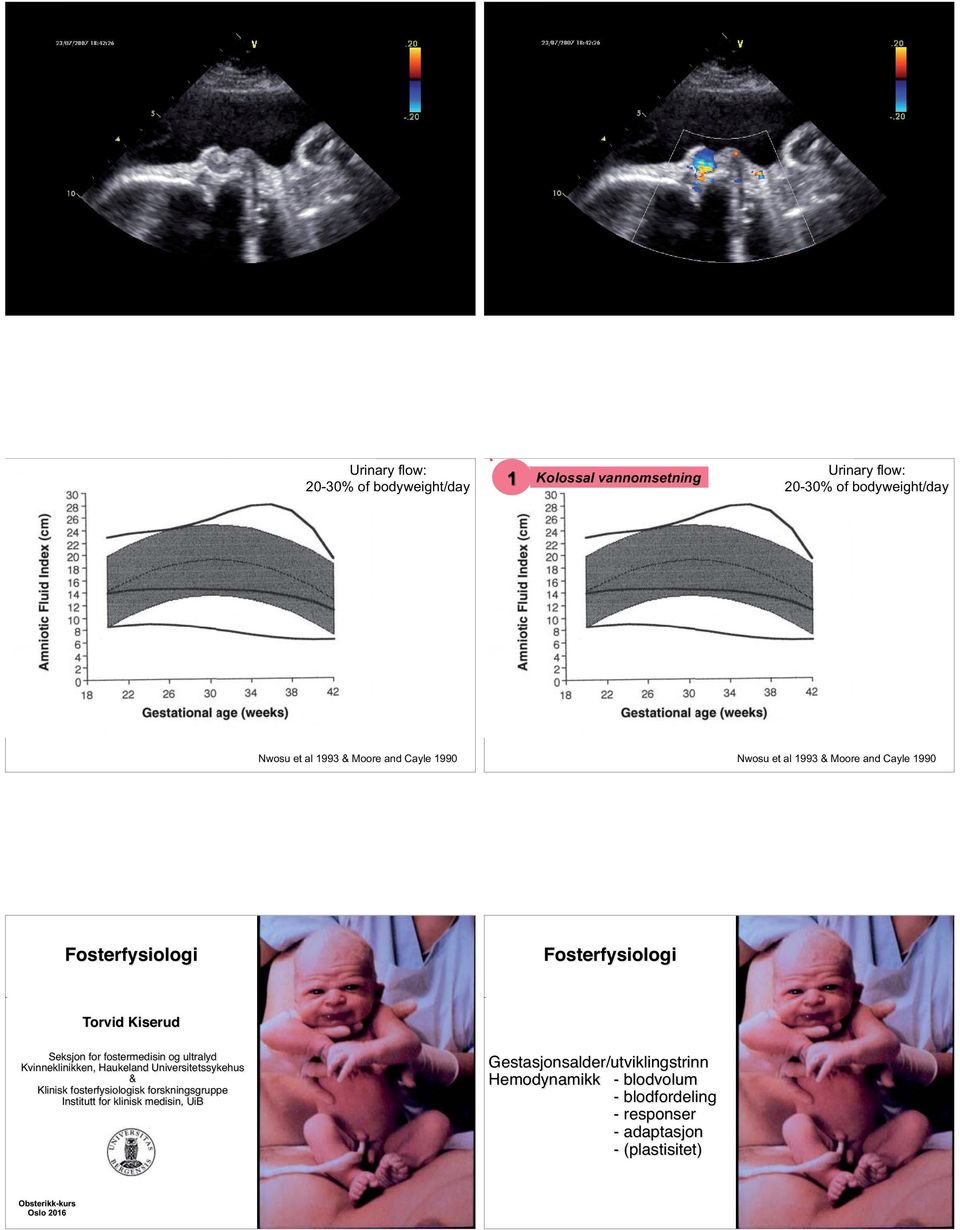 ultralyd Kvinneklinikken, Haukeland Universitetssykehus & Klinisk fosterfysiologisk forskningsgruppe Institutt for klinisk medisin,