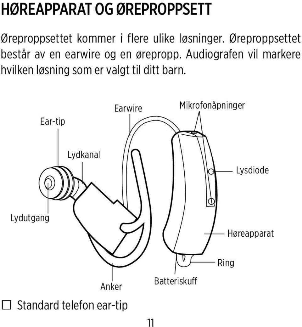 Audiografen vil markere hvilken løsning som er valgt til ditt barn.