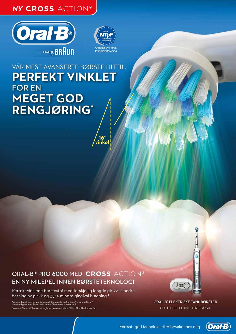 forskjellig lengde gir 22 % bedre fjerning av plakk og 35 % mindre gingival blødning.