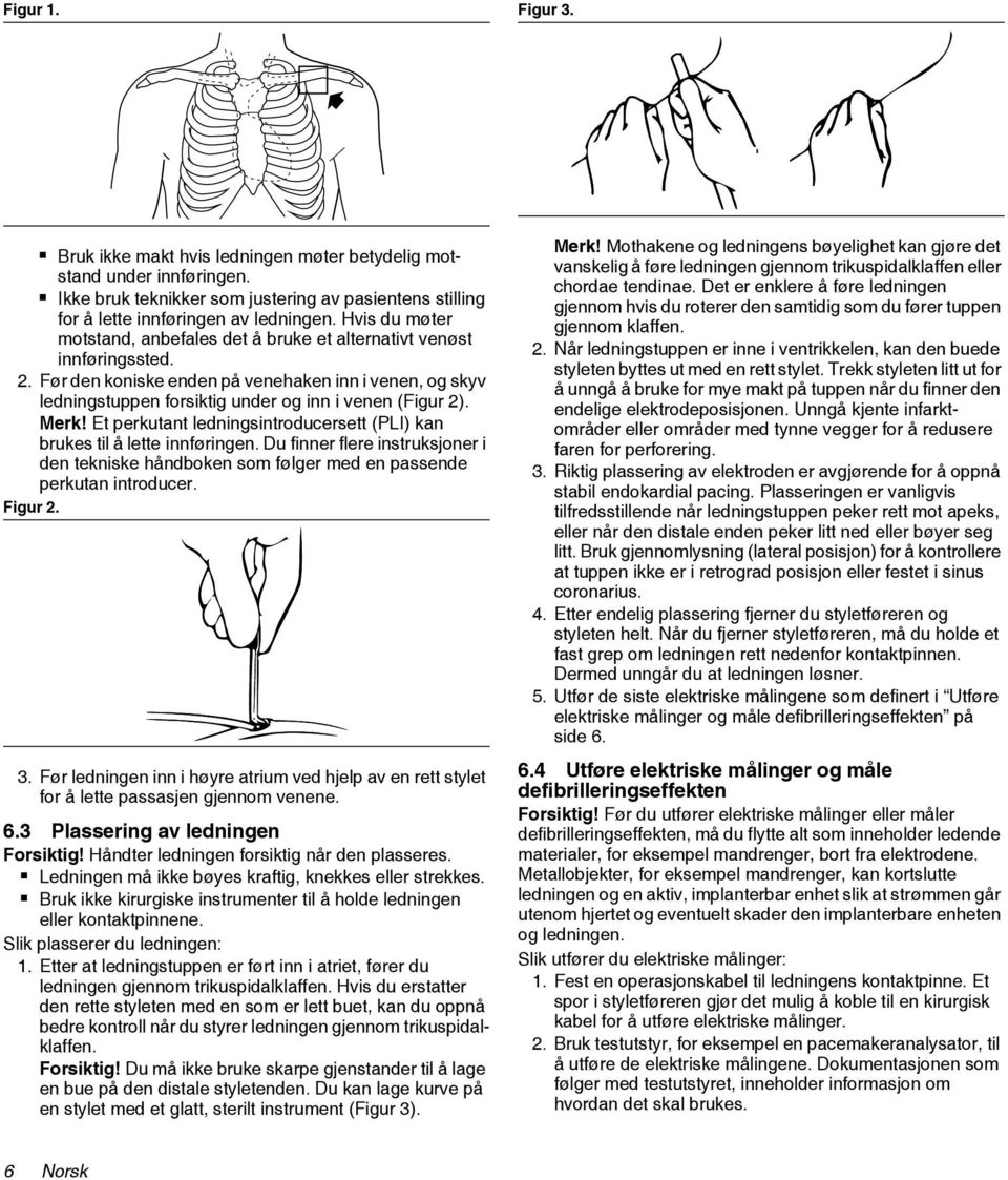 Merk! Et perkutant ledningsintroducersett (PLI) kan brukes til å lette innføringen. Du finner flere instruksjoner i den tekniske håndboken som følger med en passende perkutan introducer. Figur 2. 3.