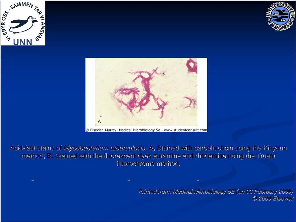 with the fluorescent dyes auramine and rhodamine using the Truant