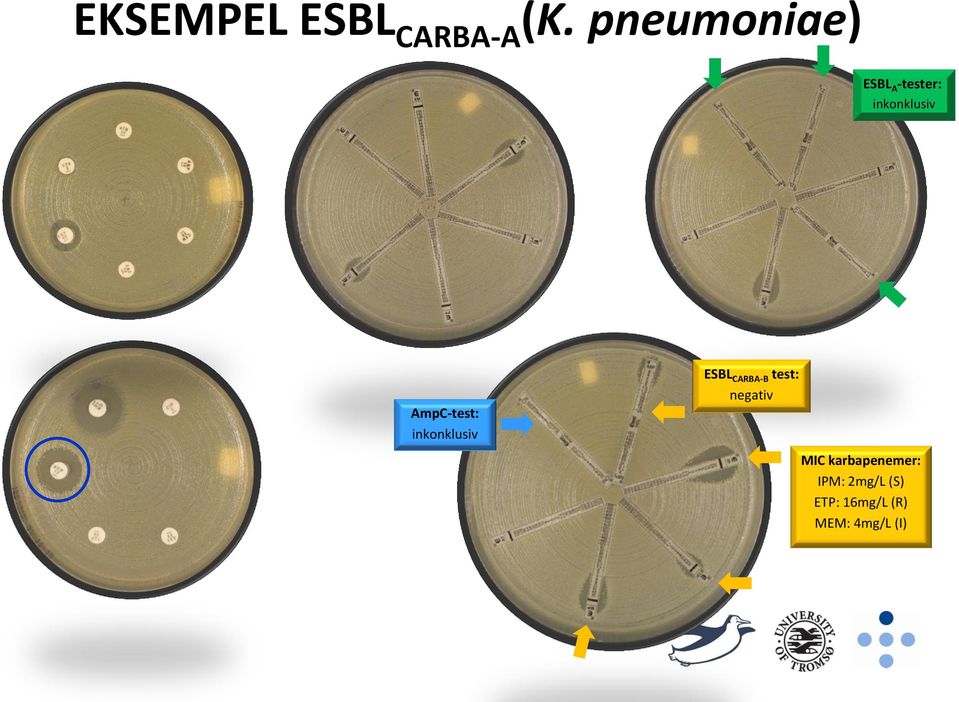 AmpC-test: inkonklusiv ESBL CARBA-B test: