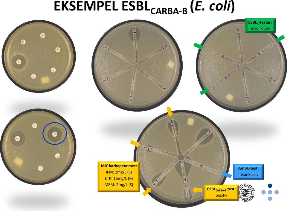 karbapenemer: IPM: 2mg/L (S) ETP: 16mg/L