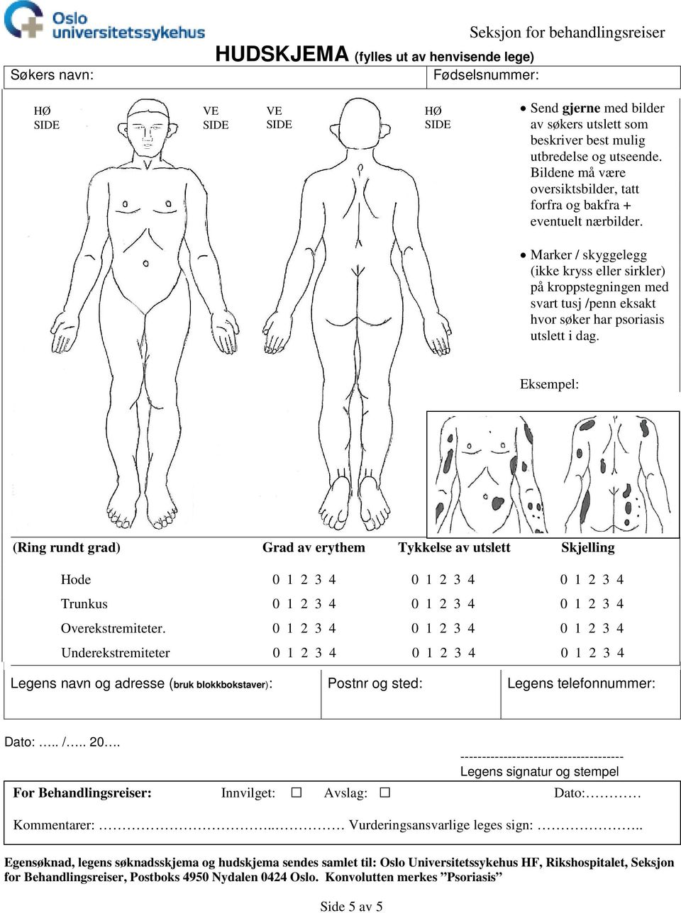 Marker / skyggelegg (ikke kryss eller sirkler) på kroppstegningen med svart tusj /penn eksakt hvor søker har psoriasis utslett i dag.