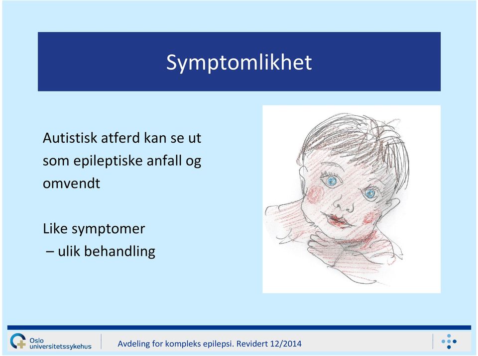 epileptiske anfall og