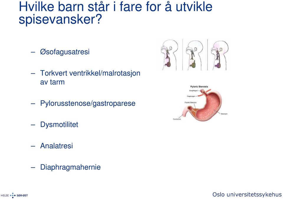 Øsofagusatresi Torkvert