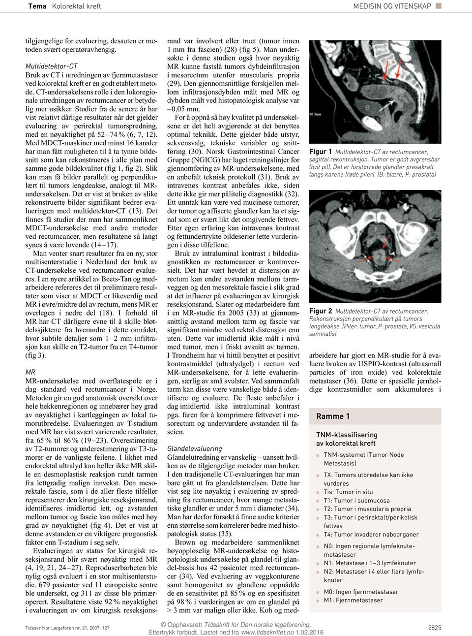 CT-undersøkelsens rolle i den lokoregionale utredningen av rectumcancer er betydelig mer usikker.