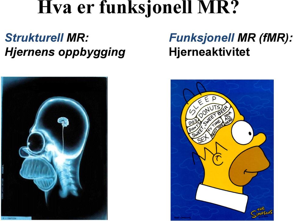 Hjernens oppbygging