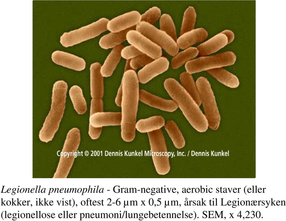x 0,5 µm, årsak til Legionærsyken (legionellose
