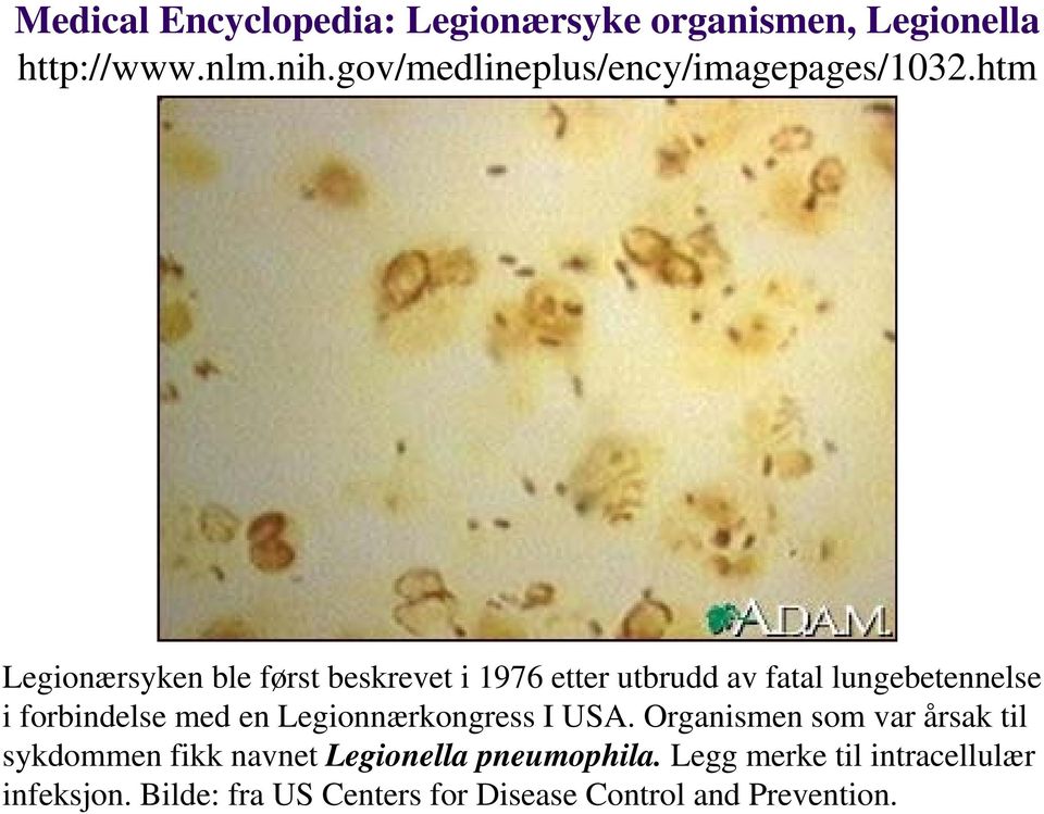 htm Legionærsyken ble først beskrevet i 1976 etter utbrudd av fatal lungebetennelse i forbindelse med