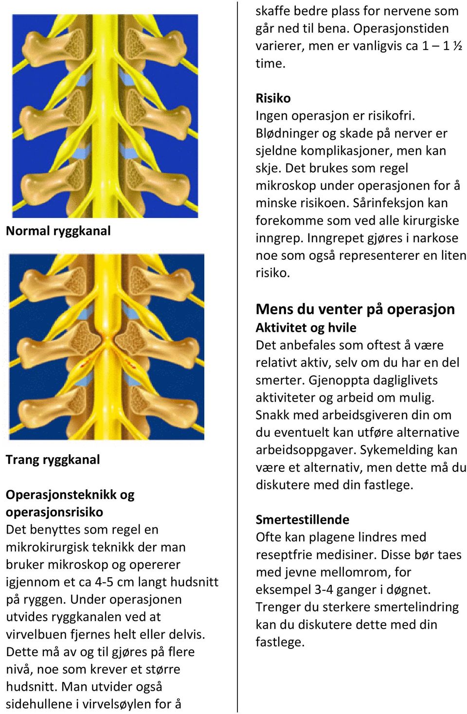 ryggen. Under operasjonen utvides ryggkanalen ved at virvelbuen fjernes helt eller delvis. Dette må av og til gjøres på flere nivå, noe som krever et større hudsnitt.