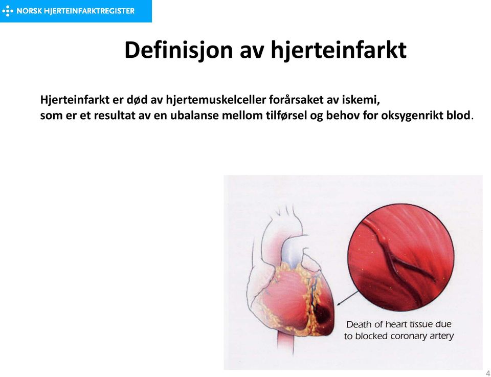 iskemi, som er et resultat av en ubalanse