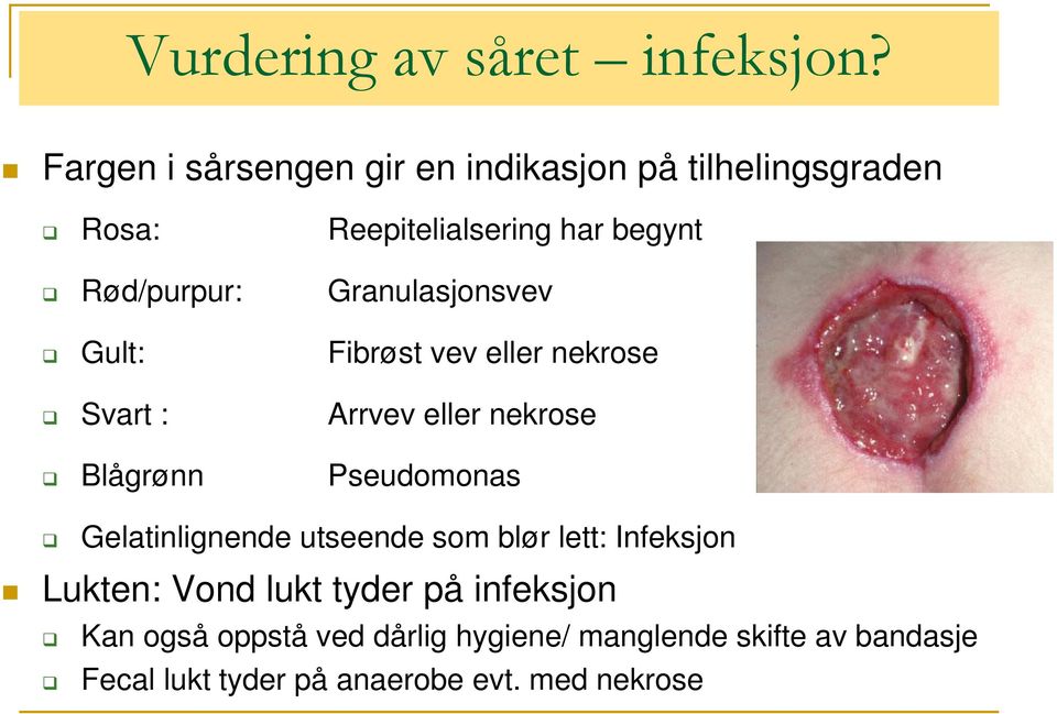 Reepitelialsering har begynt Granulasjonsvev Fibrøst vev eller nekrose Arrvev eller nekrose Pseudomonas