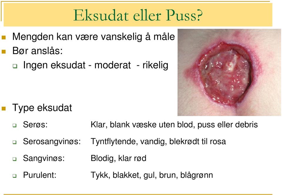 rikelig Type eksudat Serøs: Serosangvinøs: Sangvinøs: Purulent: Klar,