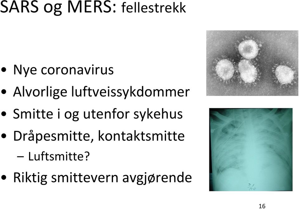 utenfor sykehus Dråpesmitte,