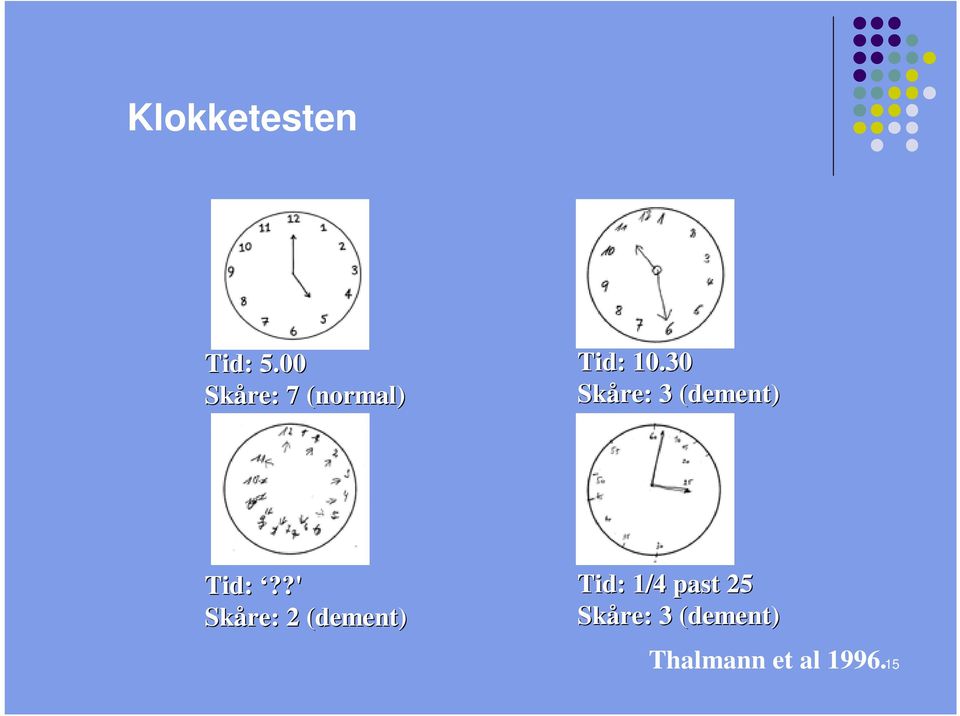 30 Skåre: 3 (dement) Tid:?