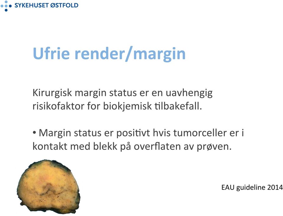 Margin status er posiovt hvis tumorceller er i