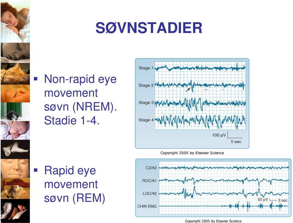 (NREM). Stadie 1-4.