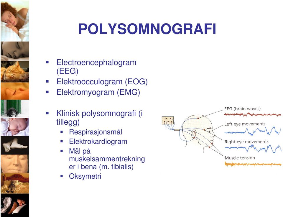 polysomnografi (i tillegg) Respirasjonsmål