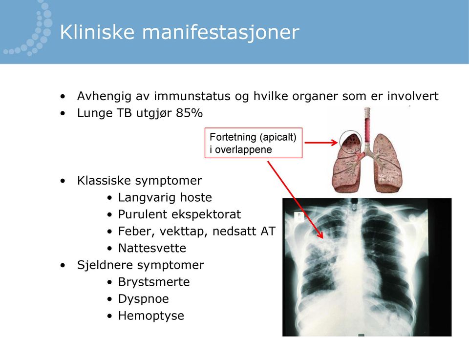 Klassiske symptomer Langvarig hoste Purulent ekspektorat Feber,