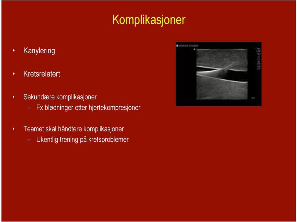 etter hjertekompresjoner Teamet skal