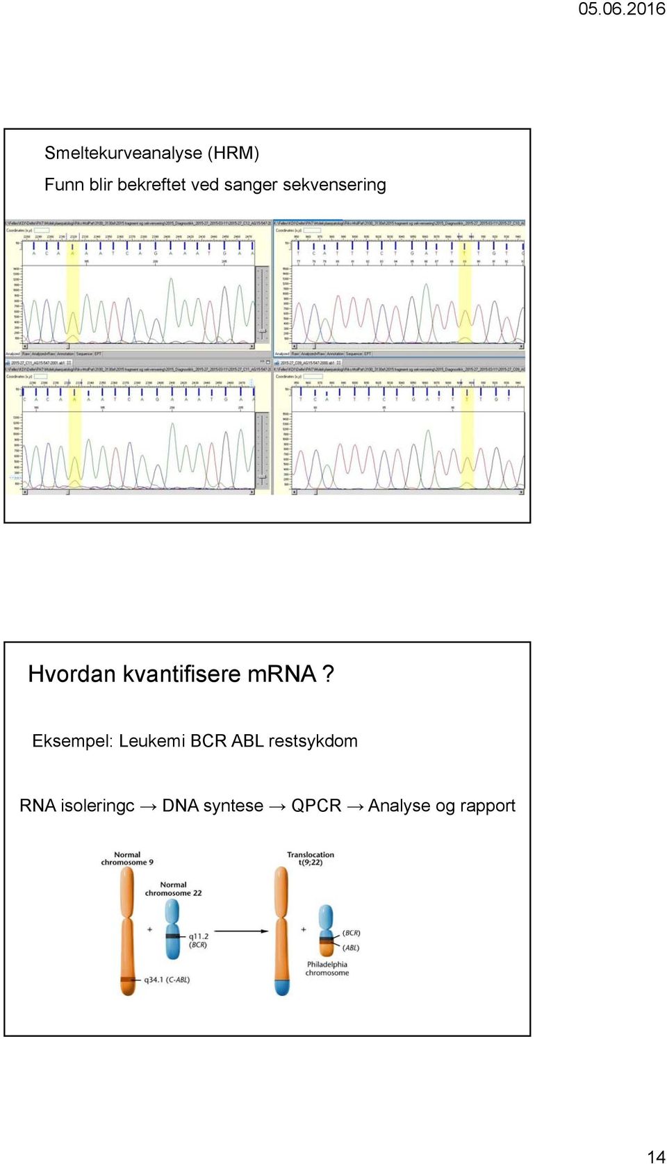 mrna? Eksempel: Leukemi BCR ABL restsykdom RNA