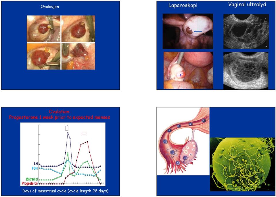 week prior to expected menses Days