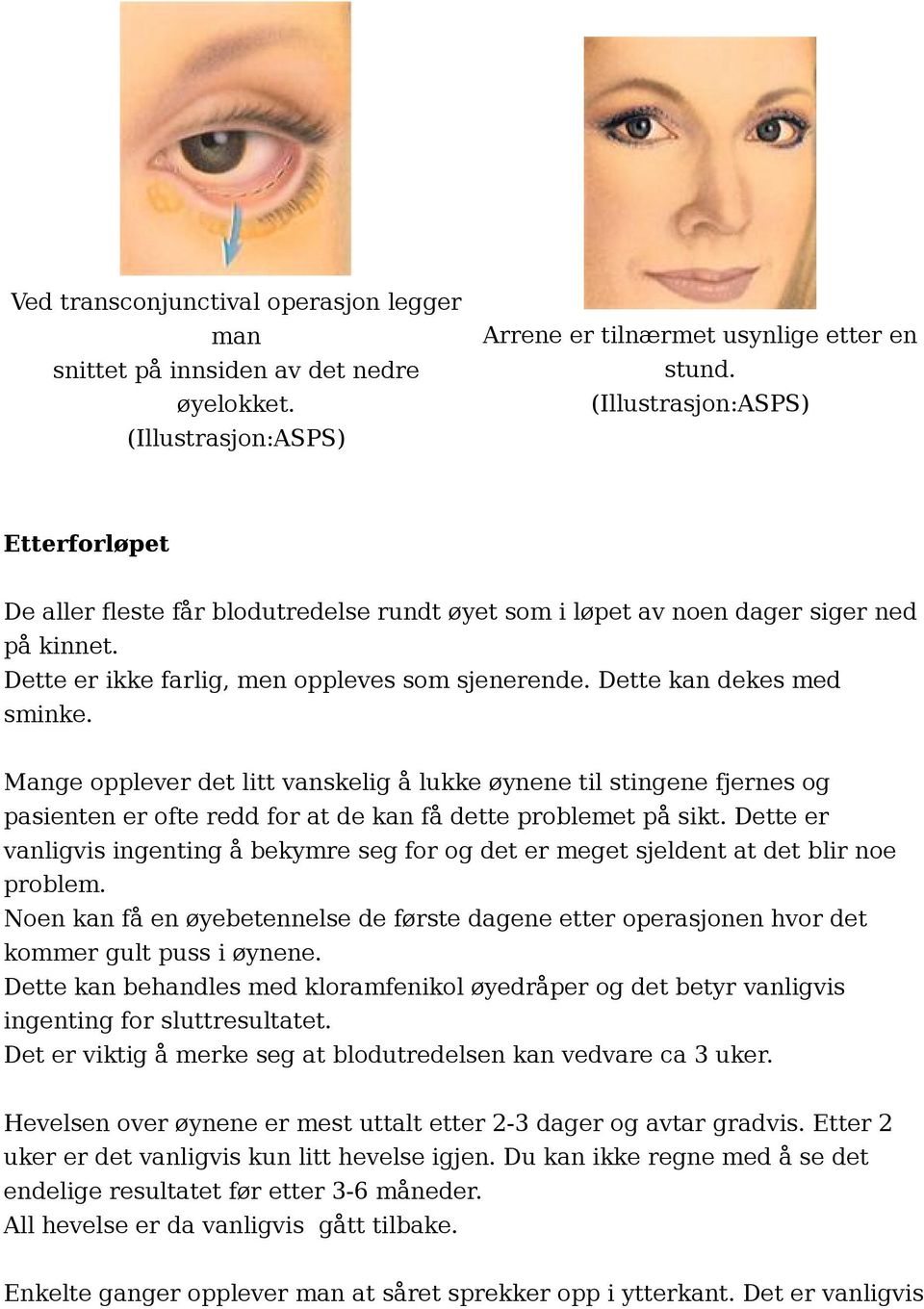 Dette kan dekes med sminke. Mange opplever det litt vanskelig å lukke øynene til stingene fjernes og pasienten er ofte redd for at de kan få dette problemet på sikt.