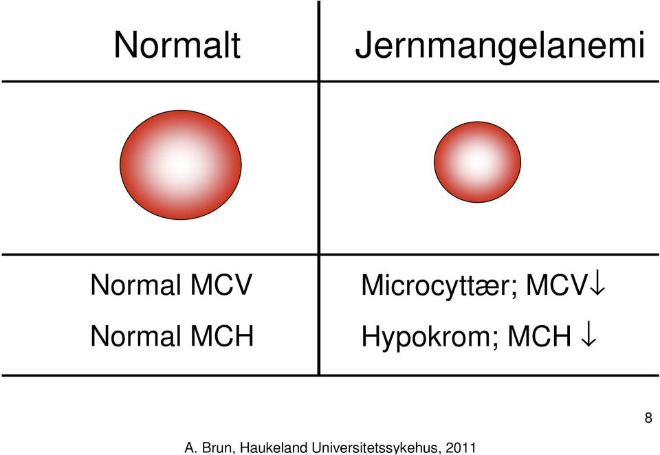Normal MCV Normal