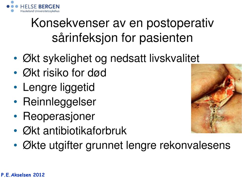 risiko for død Lengre liggetid Reinnleggelser